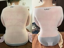 エンダモロジー サロン アンジェリノ(ENDERMOLOGIE Salon Angelino)