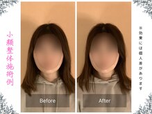 ボディ リセット アンド デザイン(Body Reset & Design)/【施術例】ビフォーアフター