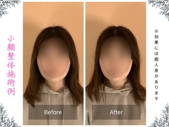 ボディ リセット アンド デザイン(Body Reset & Design)/【施術例】ビフォーアフター