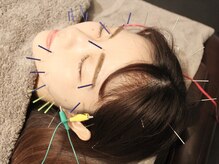 サボ 恵比寿(SABO)の雰囲気（【美容鍼】お顔/首肩/腰などお悩みの箇所を内側からアプローチ♪）