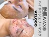 8末限！即実感♪肌質改善【フェイシャルワックス】＋鎮静マスク　体験価格☆
