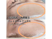 シリーラッシュ 自由が丘南口の雰囲気（自己処理不要!全顔6600円/部分のみ可　額・鼻・鼻下・あご・両頬）