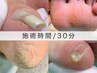 【 巻き爪 1～2ヶ所/30分 】サクッとケア♪タコ/魚の目、陥入爪や副爪も◎