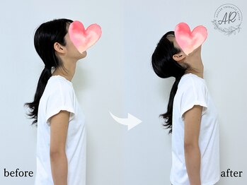 エーアール(AR)/【Before/After】3回目