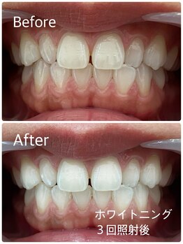 クリア(Clear)の写真/【セルフホワイトニング初回￥2980】納得がいくまで理想の白さを目指せる＊貴方のお悩み解決サロン＊