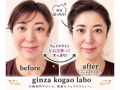 銀座小顔ラボ 文京店(GINZA KOGAO LABO)の写真