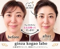 銀座小顔ラボ 文京店(GINZA KOGAO LABO)