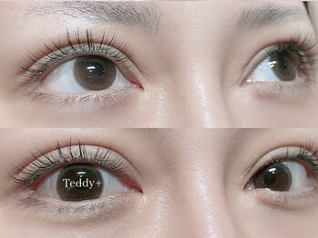 テディプラス(Teddy+)/