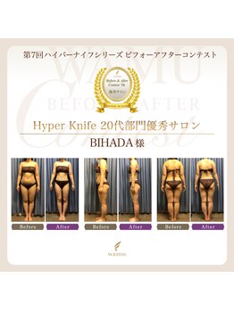 ビハダエステ 町田店(BIHADAエステ)/2021年20代部門優秀賞受賞♪