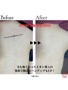 オリオンドットエスツー(Orion.S2)/【Before→After】