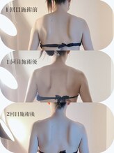 カレント(current)/ブライダルエステ¥13200