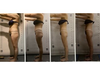 クレビア 神保町 水道橋(CREBIA)/ダイエット/痩身サロン