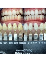 トウキョウスワーズ 池袋店(TOKYO SWRS)/#ホワイトニング #池袋 #渋谷