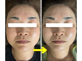 ビジュープラス 幸手店(Bijou+)/ふっくらハリ・艶