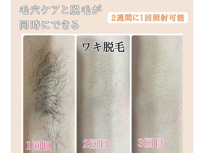 サンテ(Sante)の写真