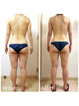 加圧ビューティーサロン スタイル エム(beauty salon style M)/40代/加圧×痩身リンパ120分