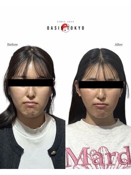 ネオオアシストウキョウ(ネオ OASIS TOKYO)/