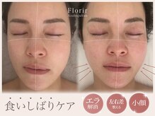 食いしばり、左右差、浮腫、慢性的な首凝りはお任せください！