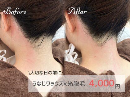 ピミル(PIMIL)の写真