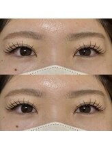 バニーアイズ 天神(Bunny eyes TENJIN)/フラット140本