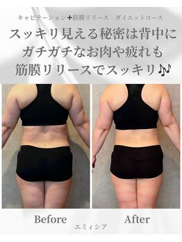 エミィシア(Emisia)/