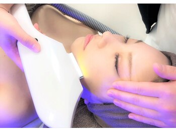 ハダケア(HADA CARE)の写真/【顔脱毛で素肌に自信】産毛をケアしてパッと明るいトーンアップ肌へ♪