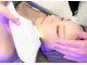 ハダケア(HADA CARE)の写真/【顔脱毛で素肌に自信】産毛をケアしてパッと明るいトーンアップ肌へ♪