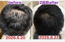 サロンノコ(salon NOKO)