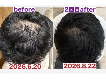 サロンノコ(salon NOKO)の写真