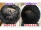 サロンノコ(salon NOKO)の写真