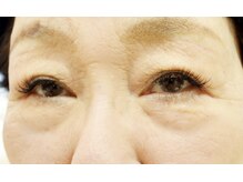 ノリージュ(Nori-jue)/デザイン[333]