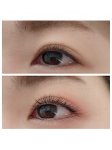 ラフィーネ(Raffine)/アッパーリフトカール