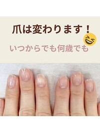 年齢性別関係なく爪は変わります