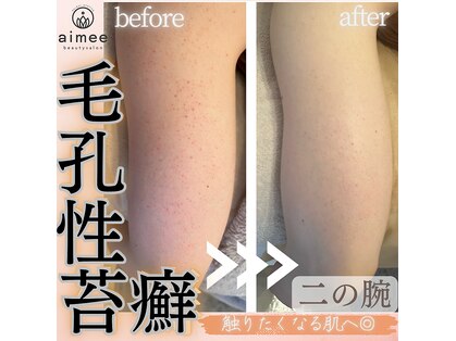 アイミー(aimee)の写真