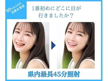 ホワイトニングショップ 豊田店(WHITENING SHOP)