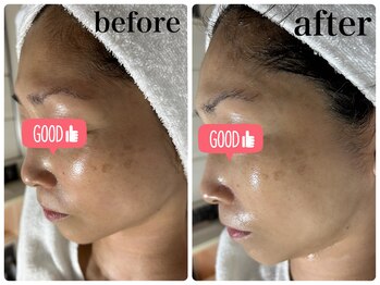 ニュウ(Nyu)/ララピール