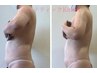 【お腹＆腰周りシェイプ】蓄積脂肪の集中ケア！脂肪分解で憧れのくびれゲット