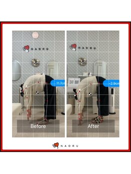 ナオル整体 北千住院(NAORU整体)/腰の痛み改善