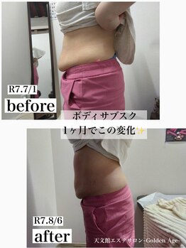 ゴールデンエイジ(Golden Age)/サブスク利用で1ヶ月の変化★