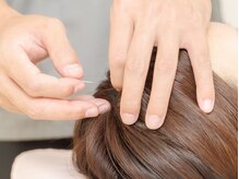 マッサージ鍼灸院つゆき按腹堂/自律神経の調整に鍼！