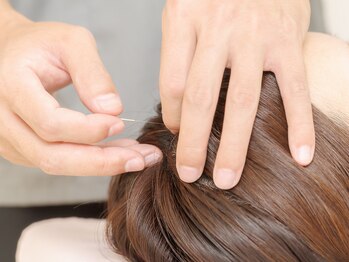 マッサージ鍼灸院つゆき按腹堂/自律神経の調整に鍼！