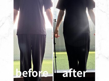 ヴレ 福岡店(Vraie)/気になるO脚も真っ直ぐ!