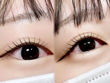 リノート アイ(LINOET eye)/ムーンロッド