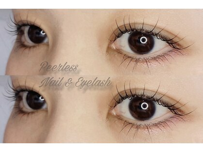 ピアレス(Peerless)の写真