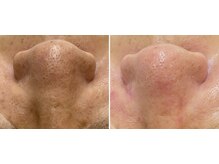 トータルビューティーサロン ナーズ(NAZ)/