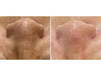 トータルビューティーサロン ナーズ(NAZ)/