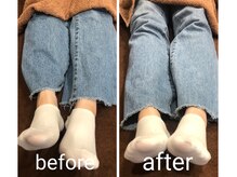 ハチ シンス 2023-(hachi-since 2023-)/産後で骨盤が開いている方必見！