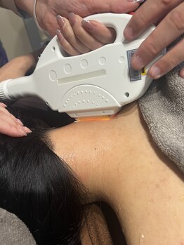 ミヤビ 竹ノ塚店(MIYA美)/うなじ脱毛は大人気♪