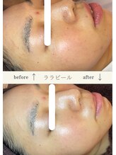 プリュベル(+belle)/◇お客様before after◇