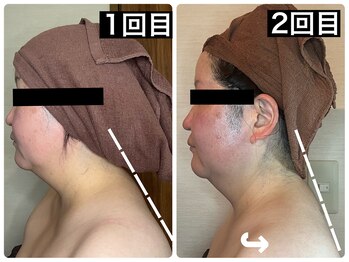 ハーズプラス(hers+)/姿勢から変わる小顔マッサージ☆